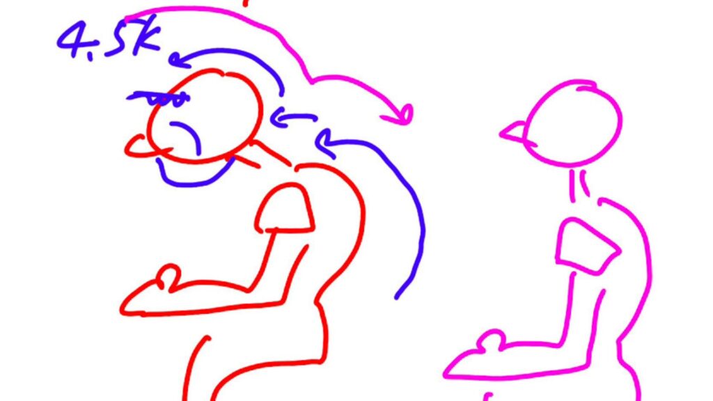 Anchorヘッドスパで姿勢矯正の説明イラスト